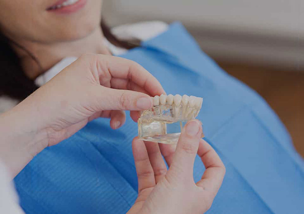 Dental Crowns & Bridges in Uxbridge