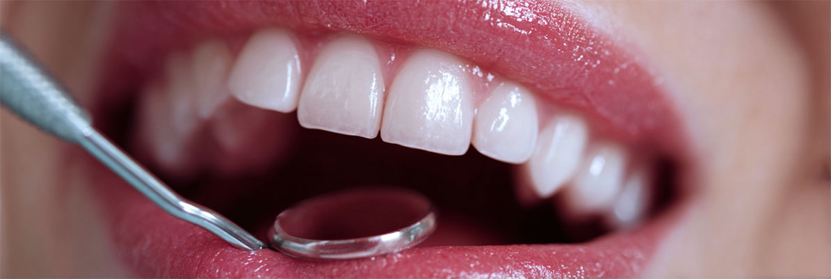 Dental Exams & Cleanings in Uxbridge